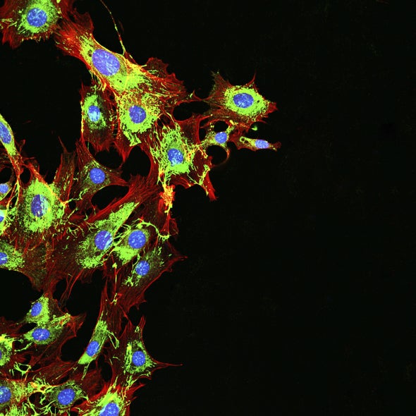 كيف تقاوم خلايا سرطان القولون العلاج الكيميائي؟