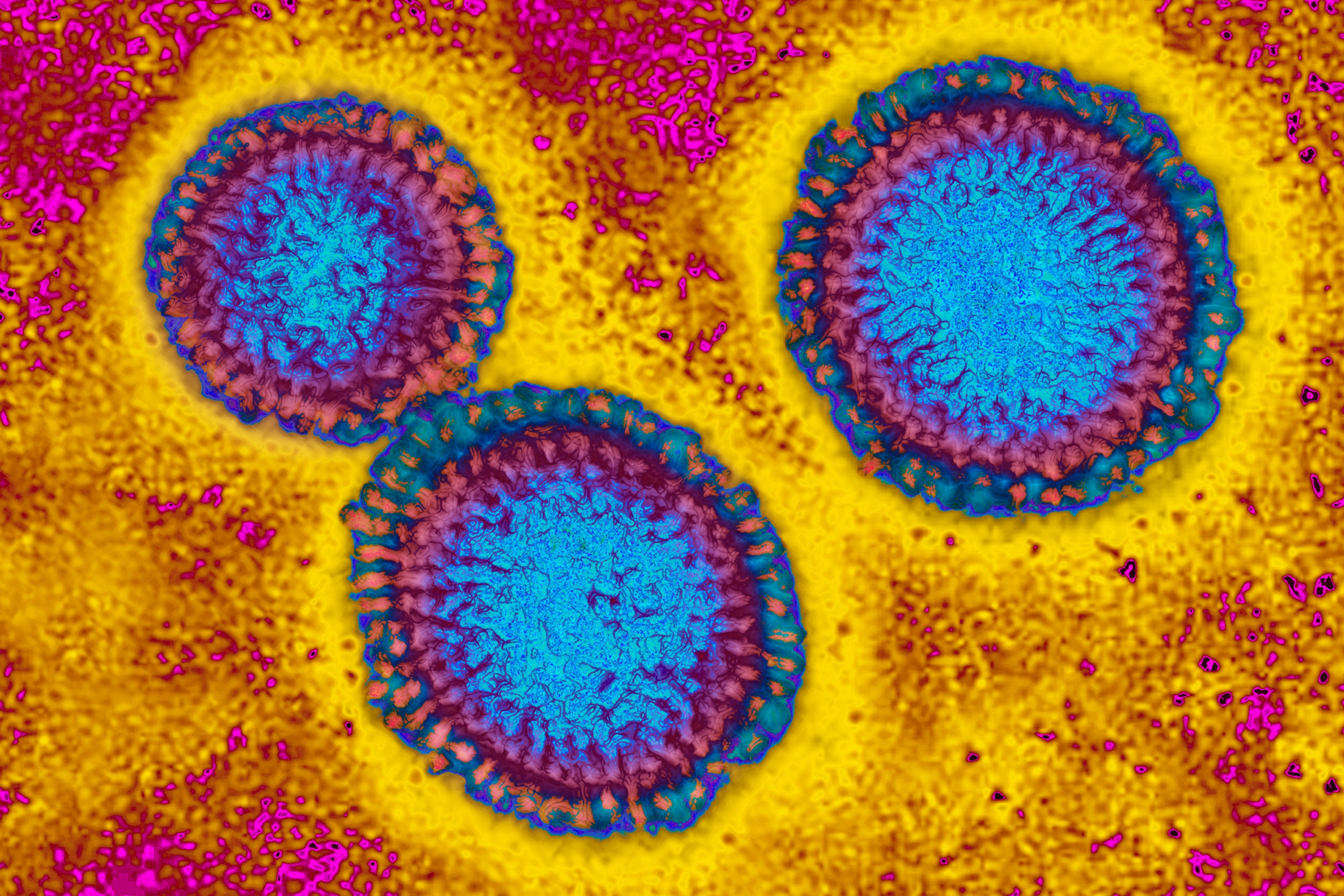 تُعد البكتيريا من مسببات مرض الإنفلونزا.