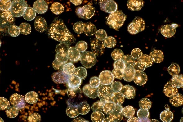 تقنية جديدة للحد من الآثار الجانبية لعلاج الأورام بجزيئات الذهب