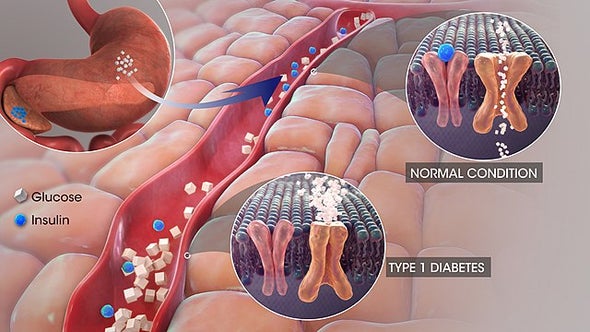 في نشرةِ العلوم.. بروتينُ "مصلِ اللبن" يُساعدُ على التحكمِ في مرضِ السكري