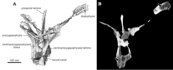 Vertebra