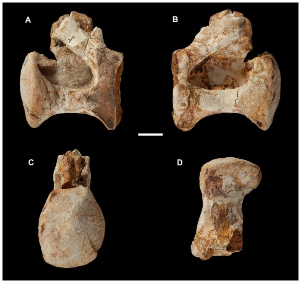 Vertebrae