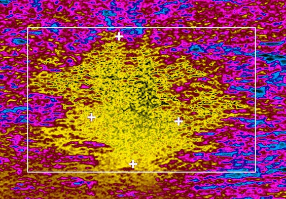A New Way to "See" Cancer