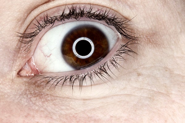 Anatomy Of A Superstition When Your Eye Jumps Scientific American Blog Network