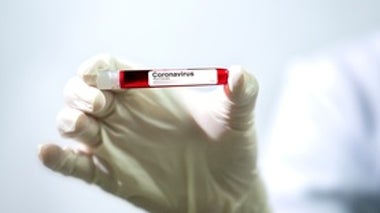 Preparing for Coronavirus to Strike the U.S.