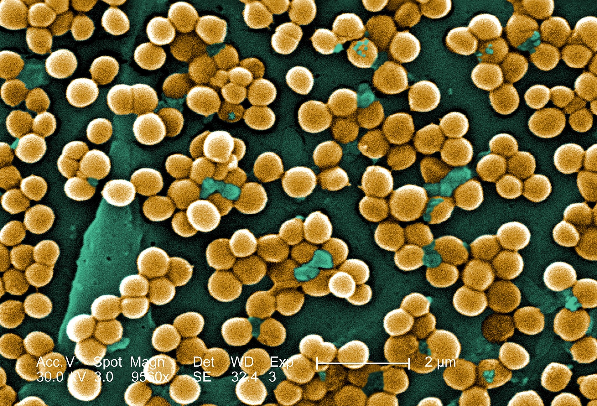 The Missing Link in Fighting Antibiotic Resistance