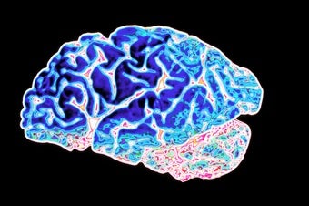 We Need New Biomarkers for Alzheimer's Disease