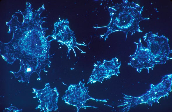 Behind the Scenes of a Radical New Cancer Cure