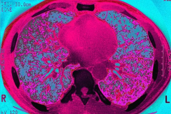 Winning the War on Tuberculosis