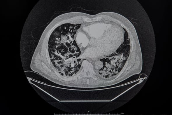Coronavirus Roundup for April 11-17