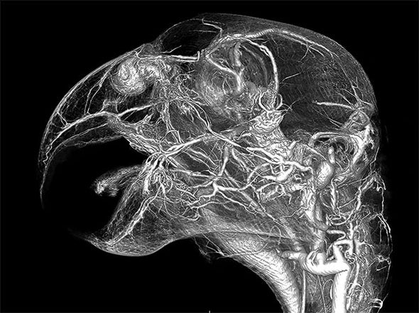 A New View of the Cardiovascular System in 3-D
