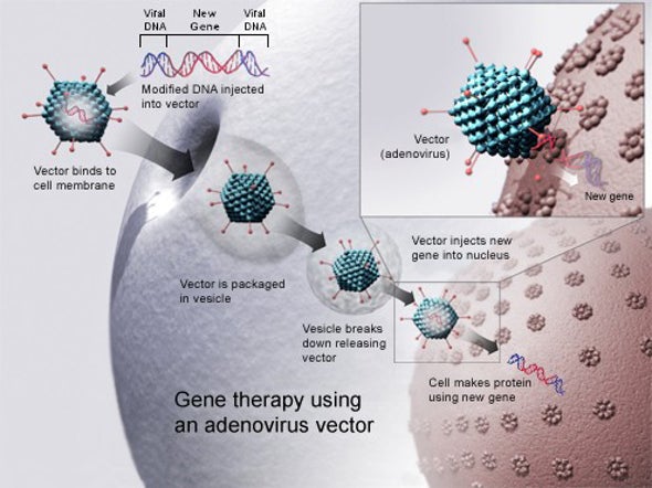 Has the Era of Gene Therapy Finally Arrived?