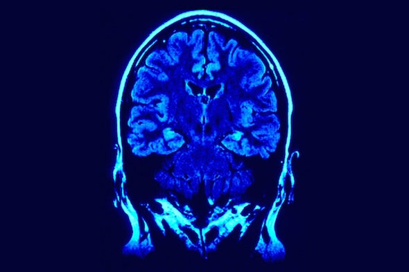 Social Stress Brain Circuitry Fails To >> What Does It Mean When We Call Addiction A Brain Disorder Social Stress Brain Circuitry Fails To >> What Does It Mean When We Call Addiction A Brain Disorder