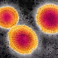 Better Diagnostics Could Help in the Fight Against Flu