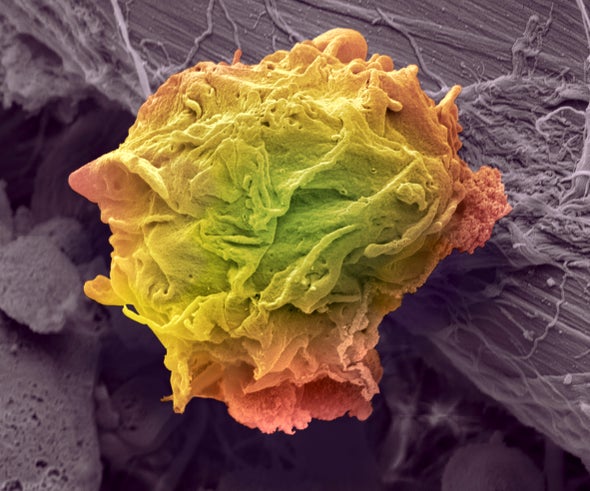 The Challenge of Finding Genome-Based Cancer Treatments