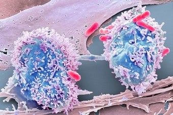 A New Idea about How Cancer Begins