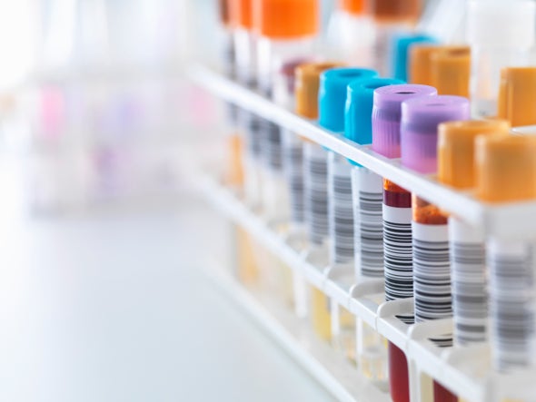 What Everyone Should Know about Lab Tests