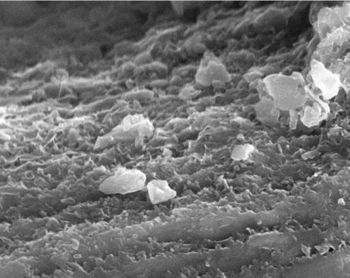 Intiibiotic Rocks Scientists Waited Two and a Half Years to See whether Bacteria Can Eat ...