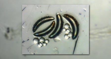 Air sacs of insect larvae