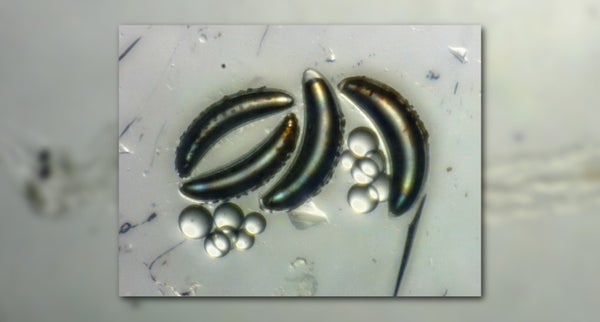 Air sacs of insect larvae
