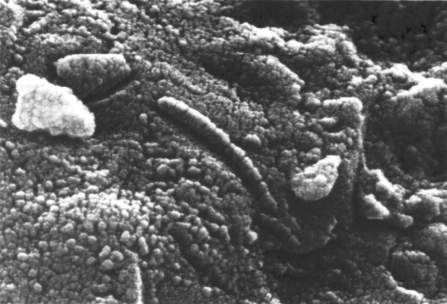 A microscopic monochromatic image of strange tubular features on a Martian meteorite that resemble biological structures.