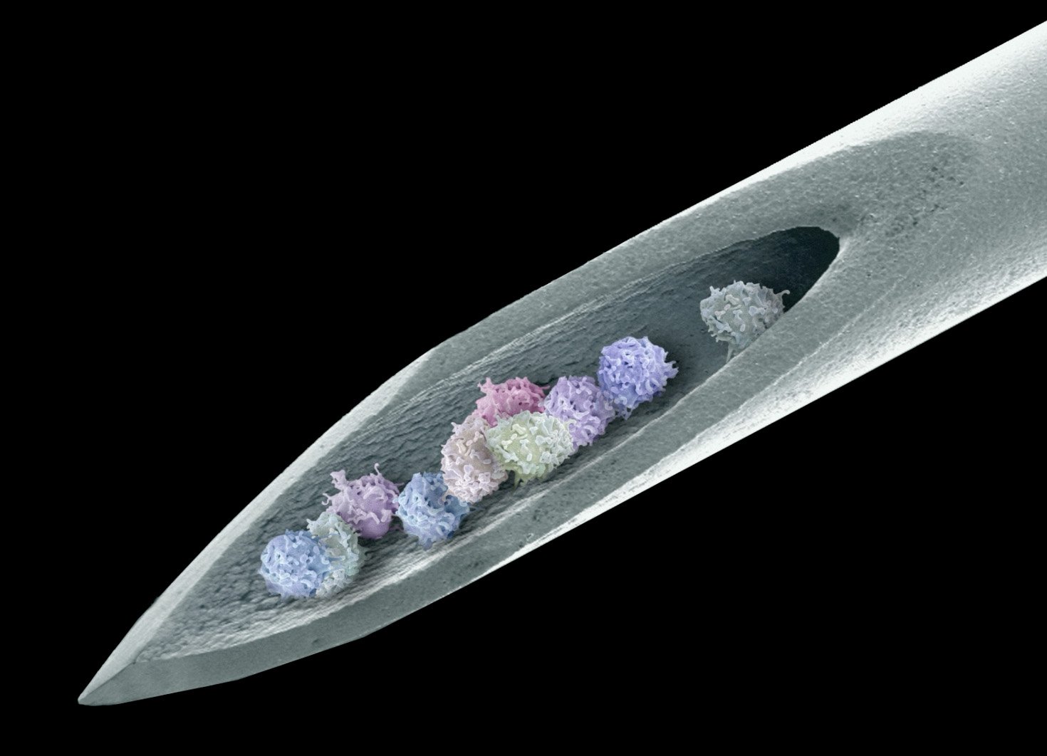 Bone marrow cells under microscope