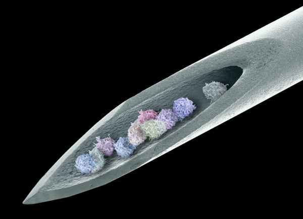 Composite coloured scanning electron micrograph of a needle with bone marrow cells inside.