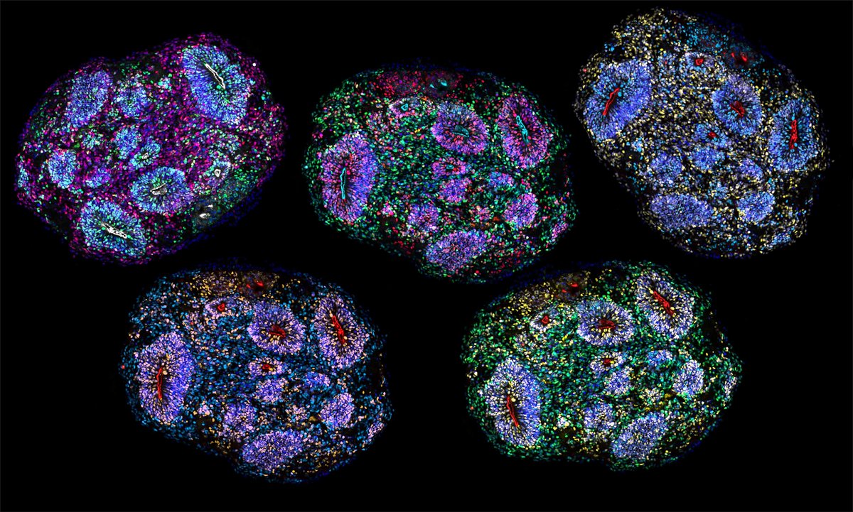 ‘Mini brains’ kept alive for years appear to age like real brains
