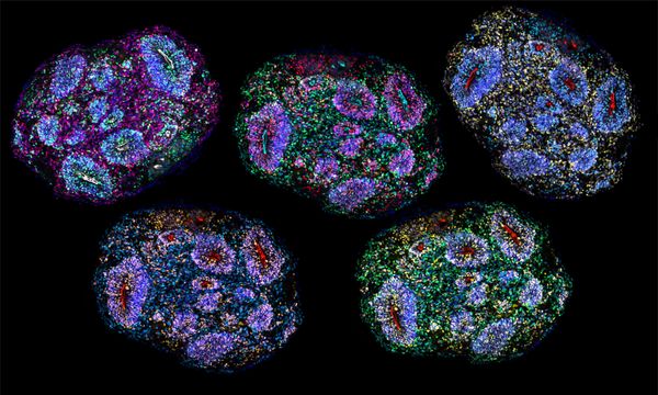 Colorful cells form five oval-shaped clumps, each representing a different slice of a brain organoid.