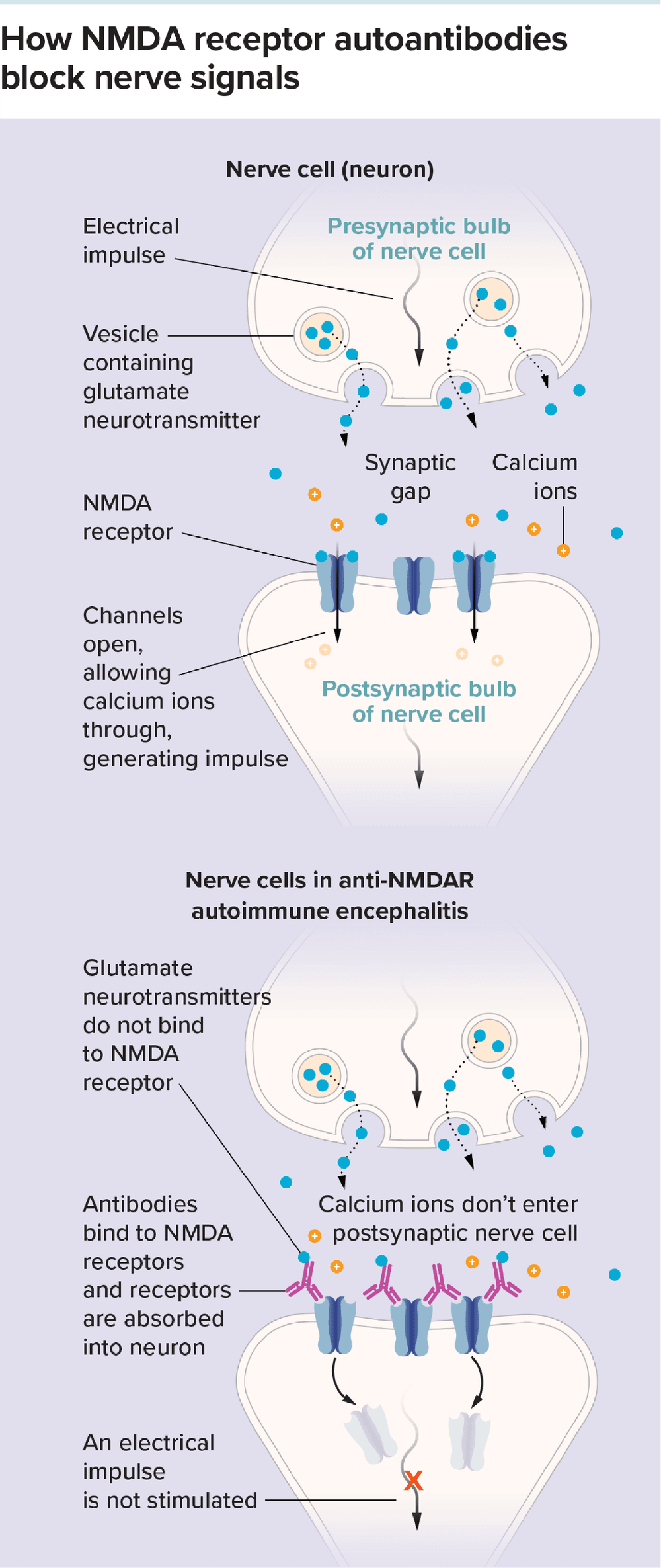 Image 1: A white, bulb-like neuron releases blue dots (glutamate neurotransmitters), which travel across the synaptic gap to bind to NMDA receptors on the surface of a second neuron. When glutamate binds to these receptors, the channels open and calcium ions pass through, generating an electrical impulse. Image 2: A neuron releases blue dots (glutamate neurotransmitters). But they cannot bind to NMDA receptors on a second neuron, because antibodies are already bound therer. The NMDA receptors absorb back into the neuron, and no electrical impulse is generated.