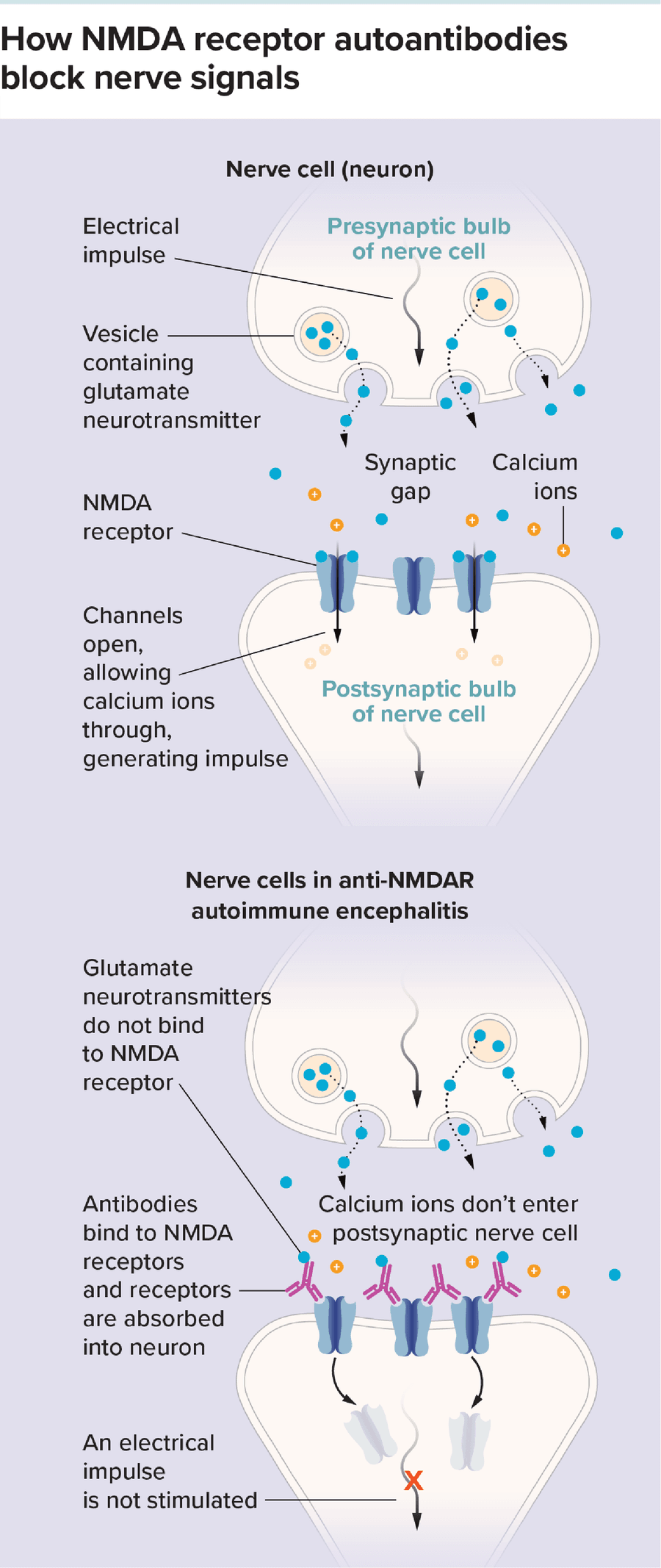 Image 1: A white, bulb-like neuron releases blue dots (glutamate neurotransmitters), which travel across the synaptic gap to bind to NMDA receptors on the surface of a second neuron. When glutamate binds to these receptors, the channels open and calcium ions pass through, generating an electrical impulse. Image 2: A neuron releases blue dots (glutamate neurotransmitters). But they cannot bind to NMDA receptors on a second neuron, because antibodies are already bound therer. The NMDA receptors absorb back into the neuron, and no electrical impulse is generated.