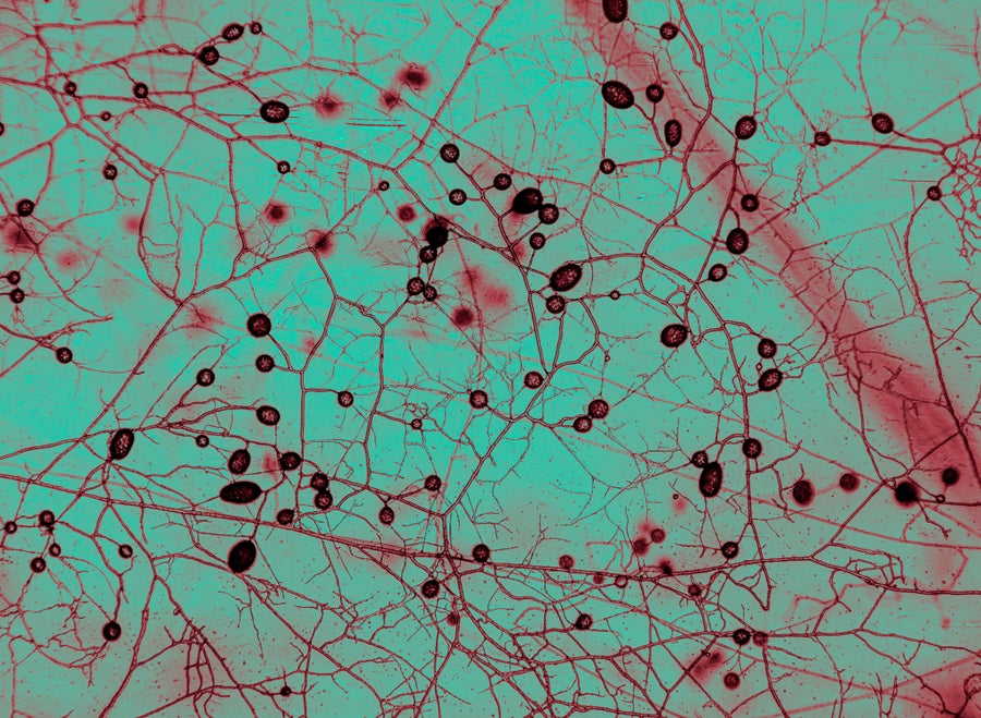 Branching red lines on a green background interspersed with darker red rings and bubbles.