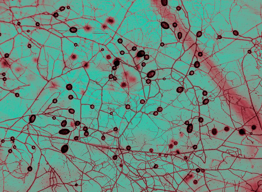 Branching red lines on a green background interspersed with darker red rings and bubbles.