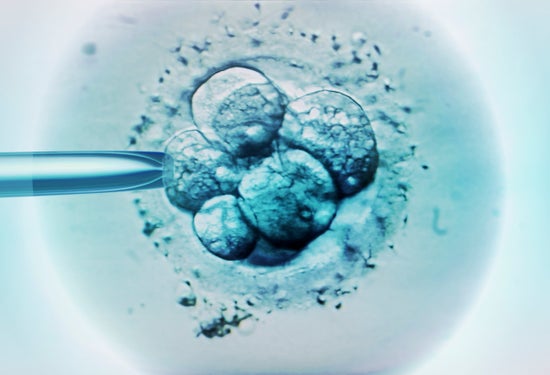 Light micrograph of embryo selection for IVF.