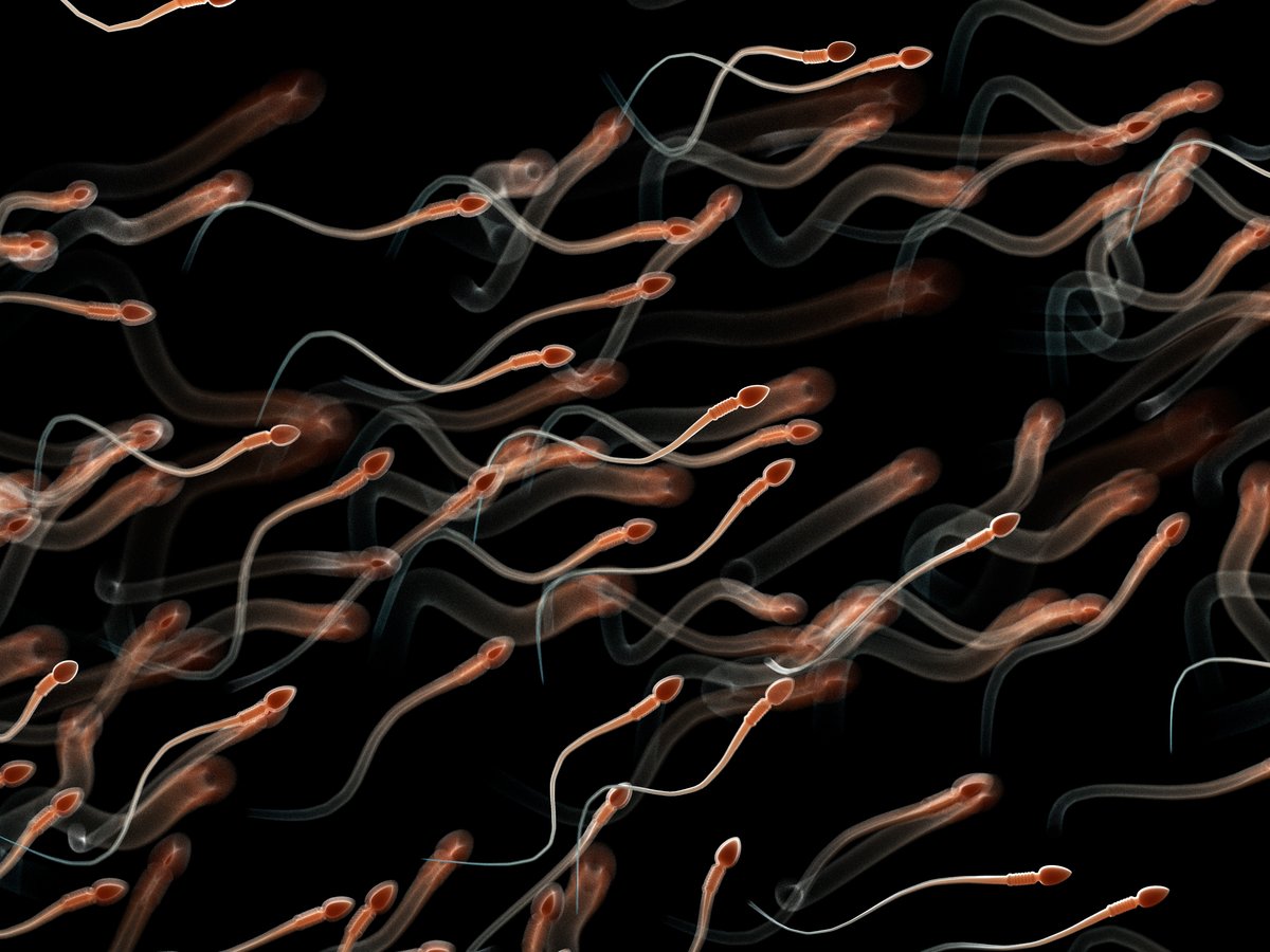 Sperm with DNA damage might be the true cause of repeated miscarriages