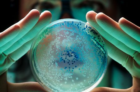 A pair of hands hold a dish full of little spots of bacterial colonies forward to the camera.