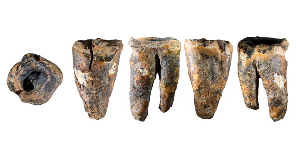 A row of photos of an ancient Neanderthal molar against a white background.