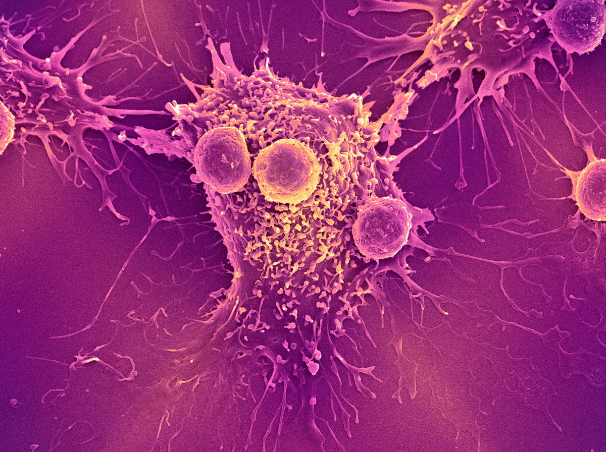 Blood test for multiple cancers clears crucial hurdle on track to FDA approval
