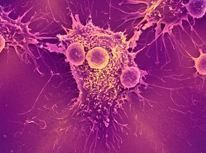 T lymphocytes and a cancer cell.