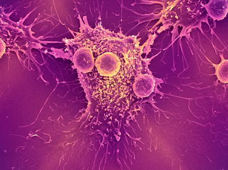 T lymphocytes and a cancer cell.