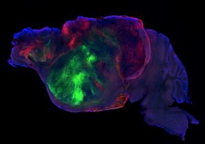 Side view of a xenocortical mouse brain showing nerve fibers extending from the human graft (colored with green and red fluorescent proteins) through the mouse brain (blue).