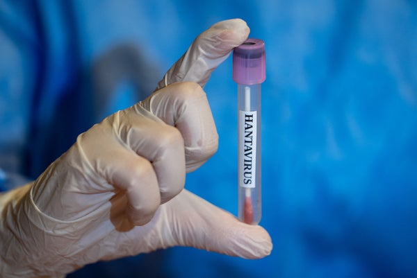 Hantavirus sample held by a hand in PPE.