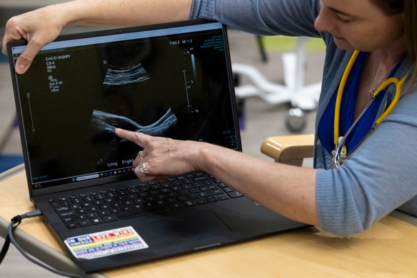 Doctor pointing to an image of an ovarian ultrasound on a laptop