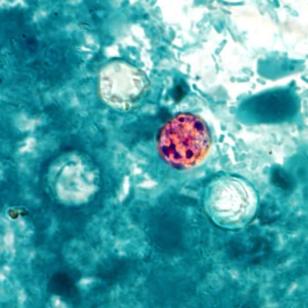 This photomicrograph of a caller stool sample, which had been prepared utilizing a 10% formalin solution, and stained pinch modified acid-fast stain, revealed nan beingness of 4 Cyclospora cayetanensis oocysts successful nan section of view