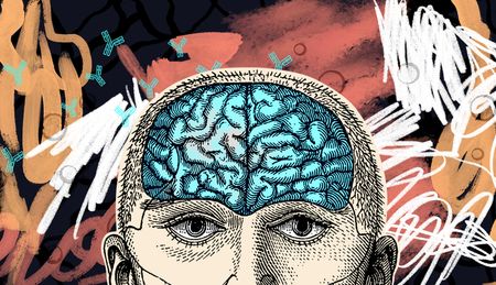 A drawing of a human head with a blue brain is surrounded by orange, red and white squiggles, with blue antibodies and white blood cells scattered across the black background.