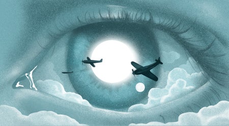 Illustration of an eye with planes passing in front of the iris.