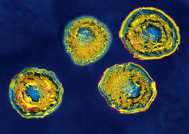 Yellow Herpes Simplex Virus Type 2 particles on dark blue background
