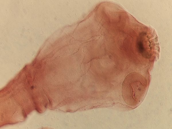 Taenia solium Scolex Showing Armed Rostellum Double Crown Hooks and Four Suckers Under Microscopy