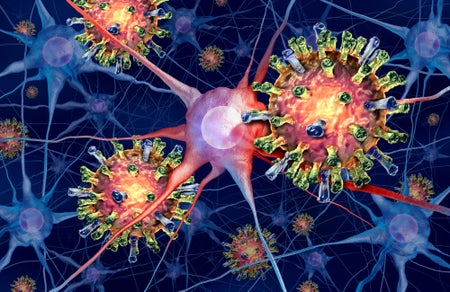 An illustration of measles virus particles attacking neurons.