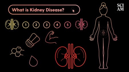 Cartoon illustrations of kidneys, a molecule, a salt shaker, a drop of water, numbers inside bubbles and of a woman's anatomical diagram showing the placement and shape of the kidneys